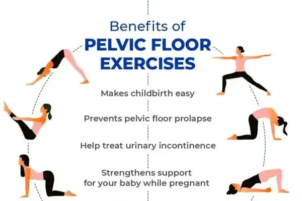 Pelvic Floor Exercises with faecal incontinence Chingford