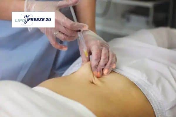 How Does Aqualyx Fat Dissolving Injection Work to Break Down Fat Chingford?