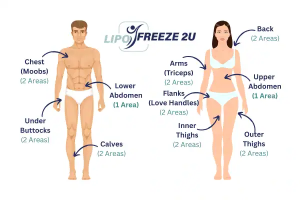 Areas you can have fat freezing treatment Chingford