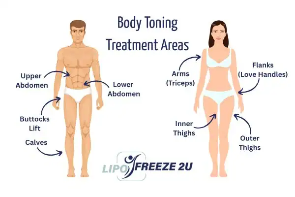 Graphic showing where you can have Body toning Treatment Chingford on your body