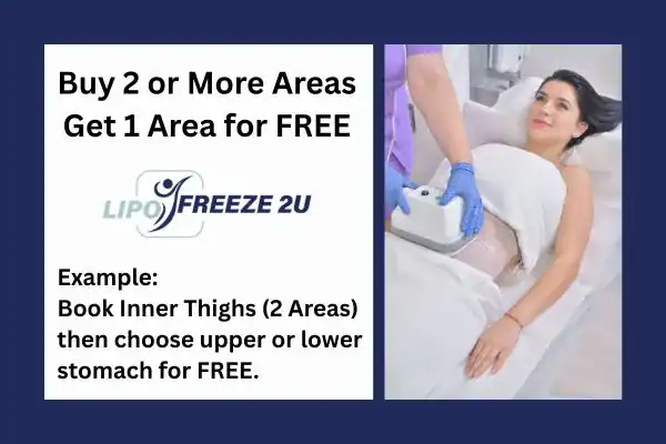 fat freezing prices Chingford