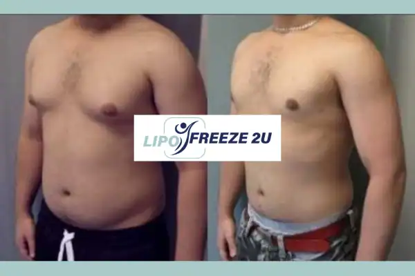 How Long Does It Take to See Results Chingford?